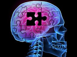 Alzheimer’s drug trial success article image