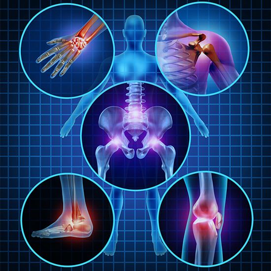 Graphic showing bones with joints marked red indicating locations of pain