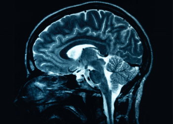 COVID attacks the brain article image