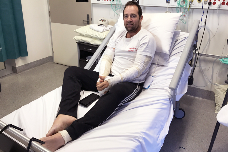 Burns patient Michael Walker