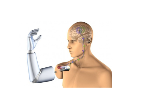 TMR-osseointegration