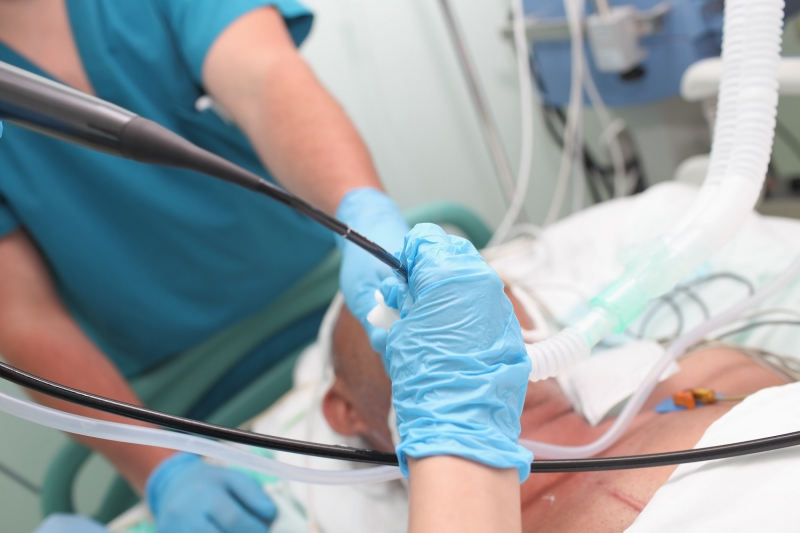 Doctors performing a bronchoscopy on a patient