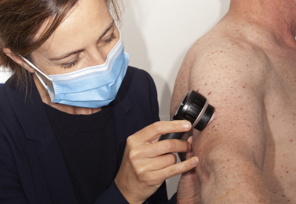 World-first approach to improve melanoma outcomes arrives at The Alfred article image